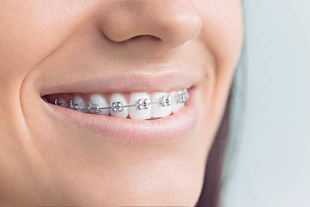 Best Tooth Extraction  in Brownwood, TX